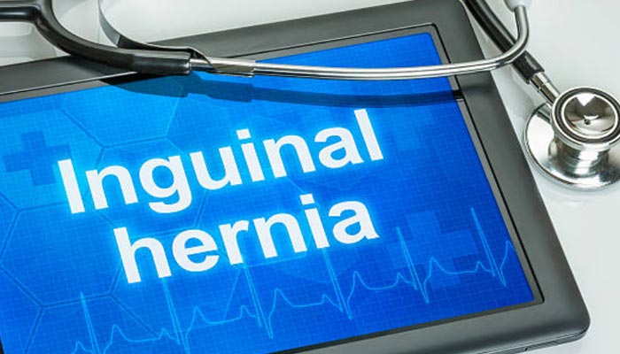Hernia-Inguinal